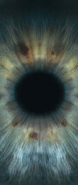 Eyes by Miss Meg Minasian at The MW Clinic London